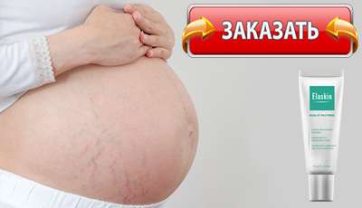 Elaskin купить в аптеке.