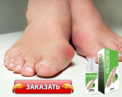 Гель Valgusmend купить по доступной цене.
