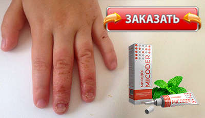 Микодер купить в аптеке.